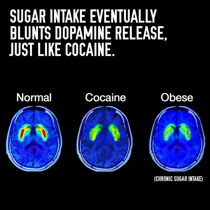 Sugar Intake Dopamine Brain